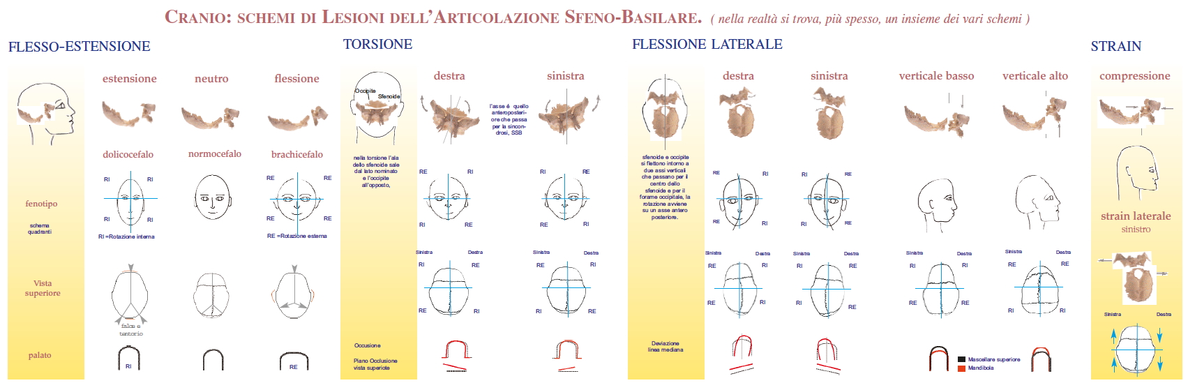 sincondrosi sfeno basilare